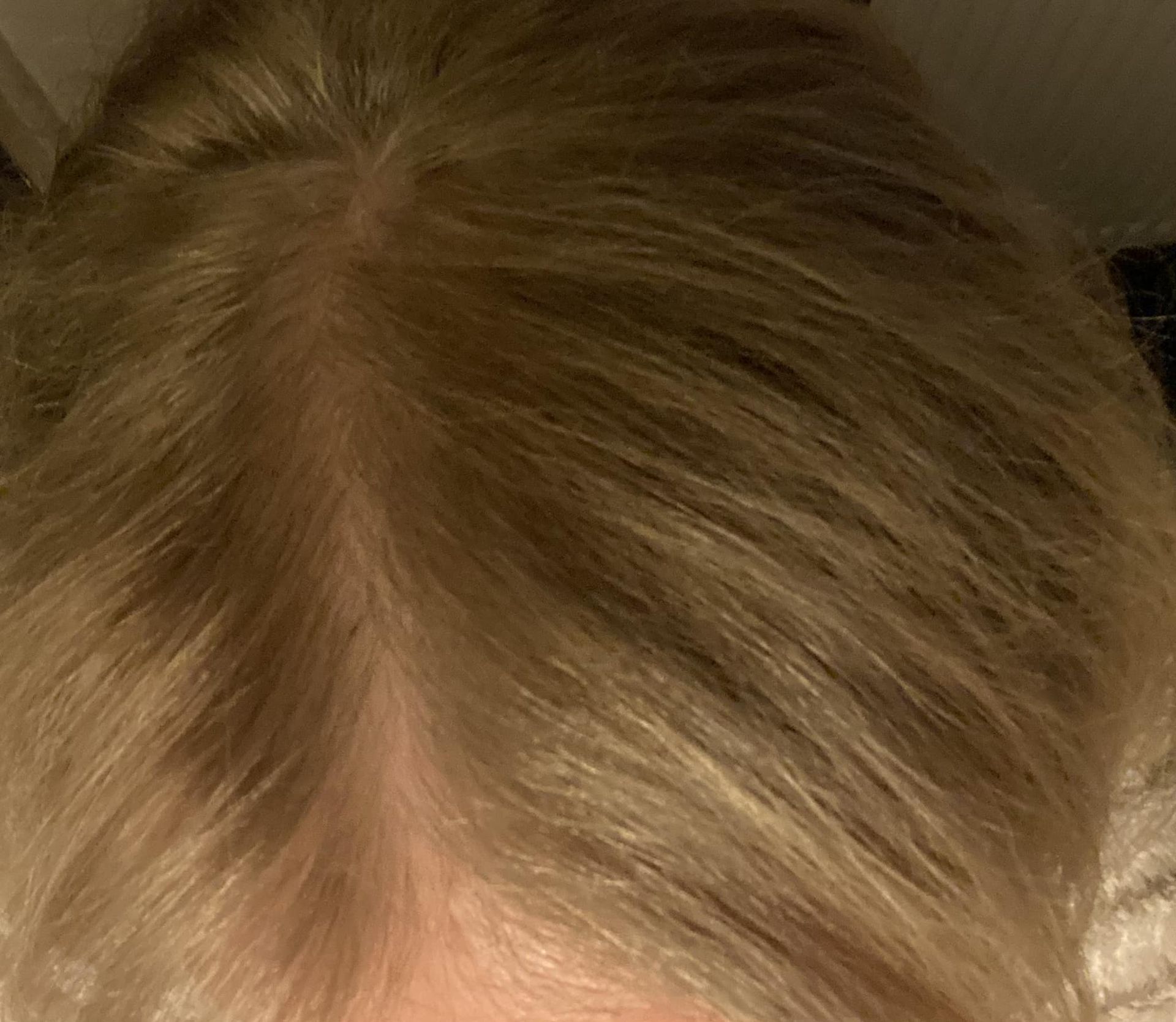 Cheveux qui se reteintent avec l'Iteracare Cheveux qui se reteintent avec l'Iteracare