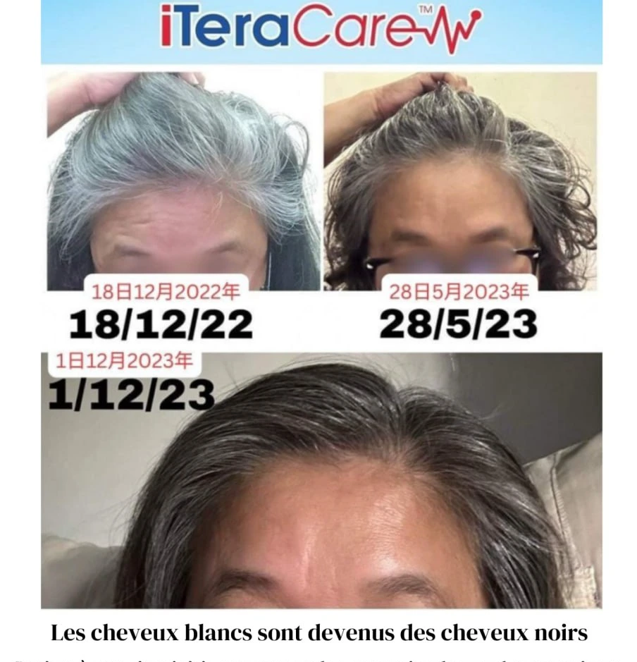 Observation d’une évolution de la couleur des cheveux après utilisation de l’Iteracare, avec un aspect plus foncé et plus homogène.